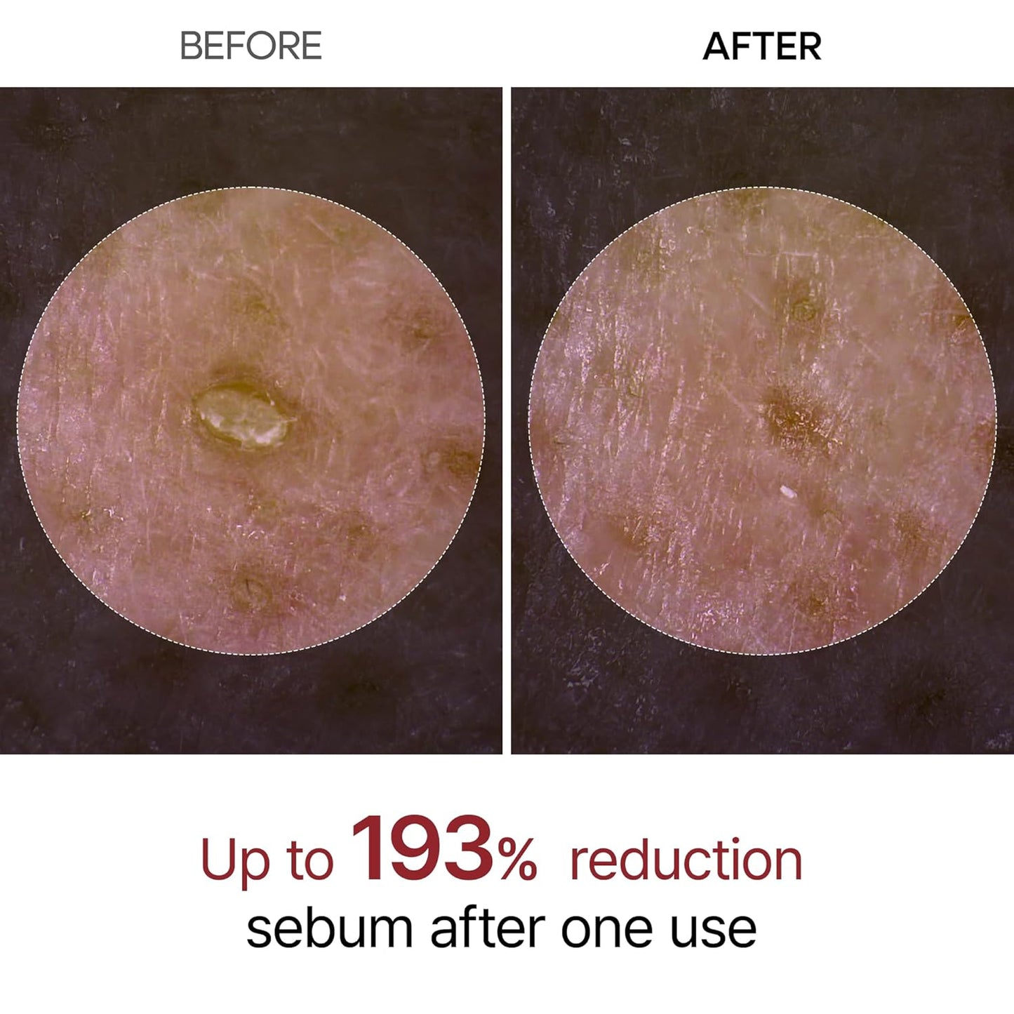 Exfoliating Rice Peel Duo – Instantly Removes Dead Skin