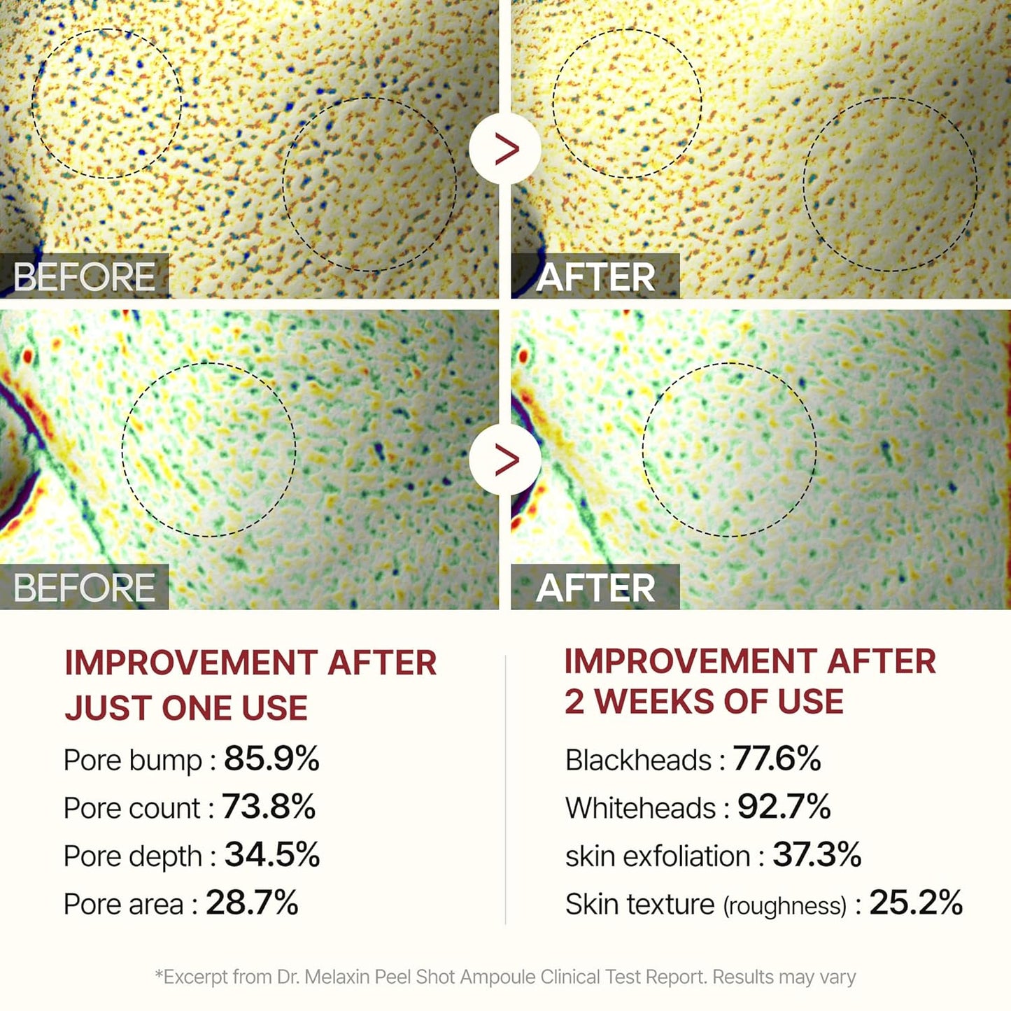 Exfoliating Rice Peel Duo – Instantly Removes Dead Skin