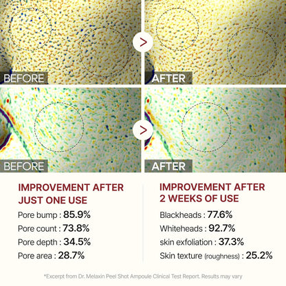 Exfoliating Rice Peel Duo – Instantly Removes Dead Skin