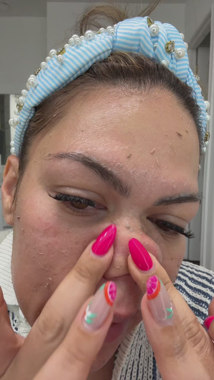 Exfoliating Rice Peel Duo – Instantly Removes Dead Skin